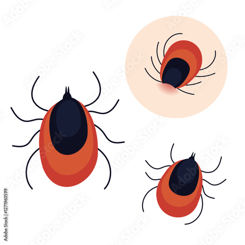 Vector illustration of a tick in different views, including a close-up and a bite on the skin. Detailed depiction of a parasitic arachnid, symbolizing disease transmission, Lyme disease risk