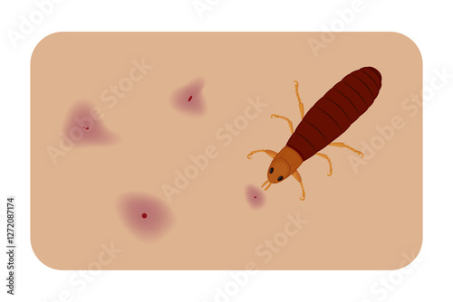 Flea causing skin irritation and red spots