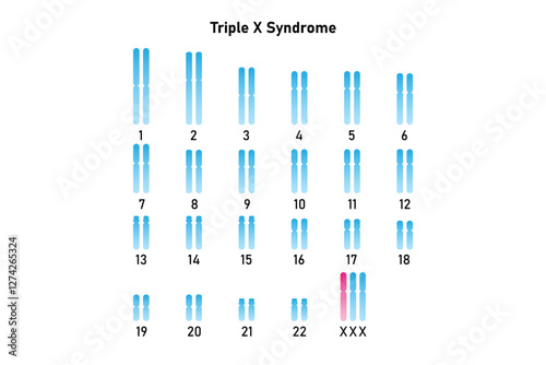 Triple X Syndrome Science Design. Vector Illustration.