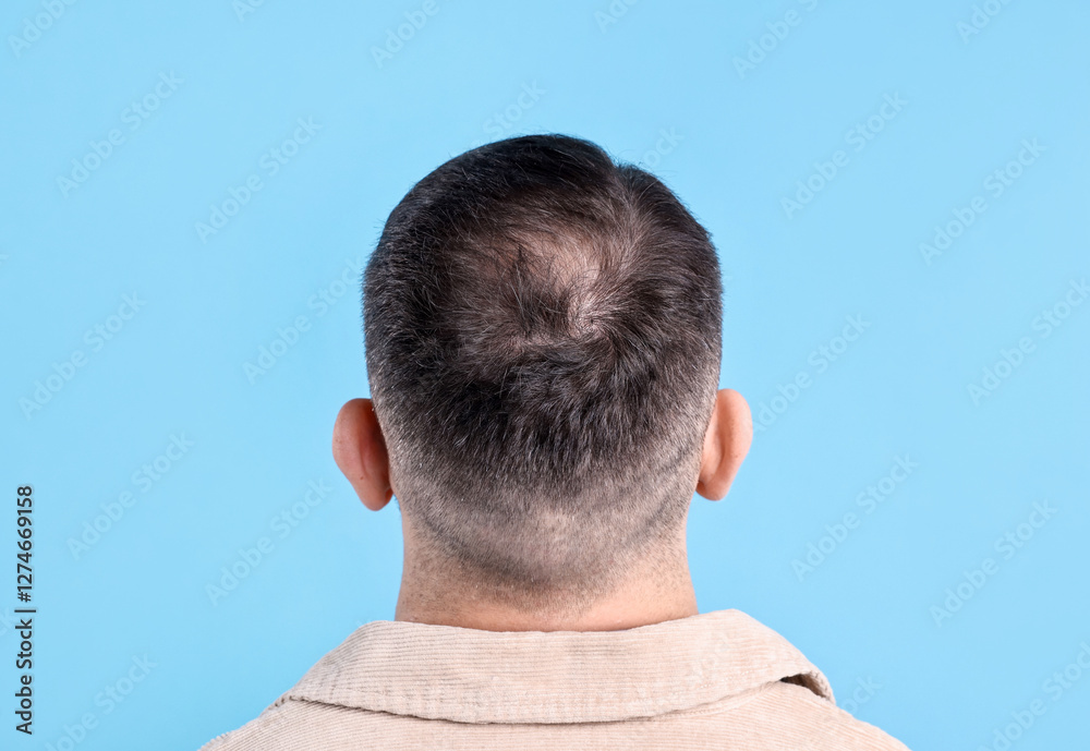 Obraz premium Baldness problem. Man with bald spot on light blue background, back view