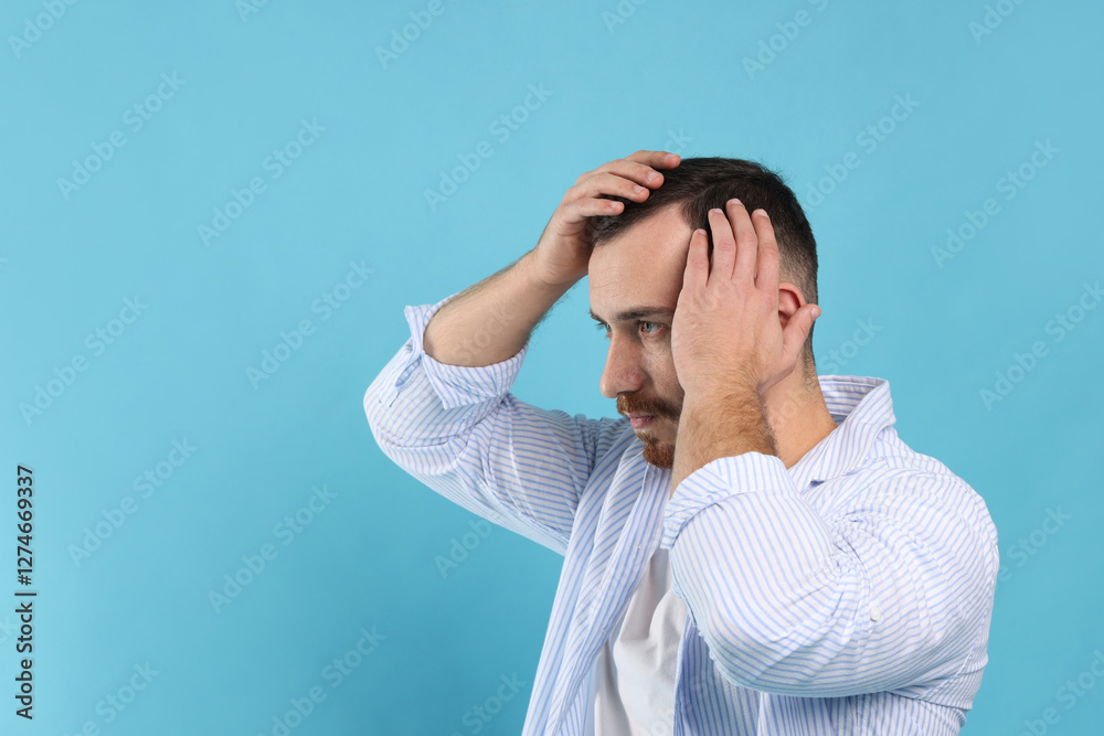 Baldness problem. Man with receding hairline on light blue background, space for text Baldness problem. Man with receding hairline on light blue background, space for text