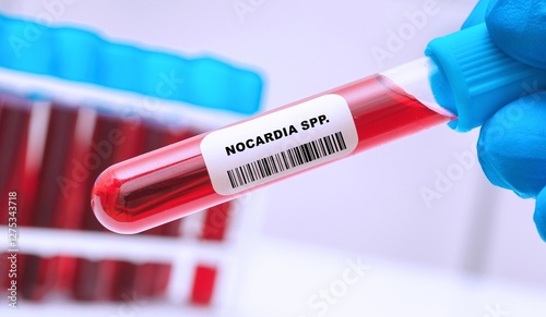 Nocardia spp photo