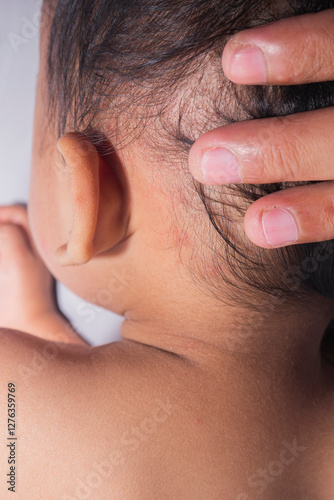 Red skin behind the ears caused by itching, irritation, prickly heat. Irritation due to soap, shampoo and skin moisturizers. concept of skin health in toddlers.