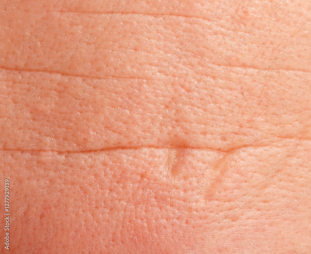 Fototapeta premium A close up of a person's arm with a red rash on it