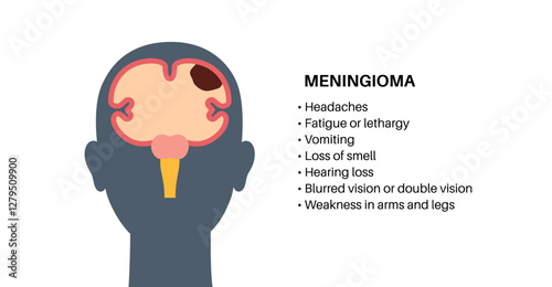 Meningioma cancer symptoms