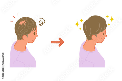 薄毛の女性の治療前と治療後のイラストセット（俯瞰）