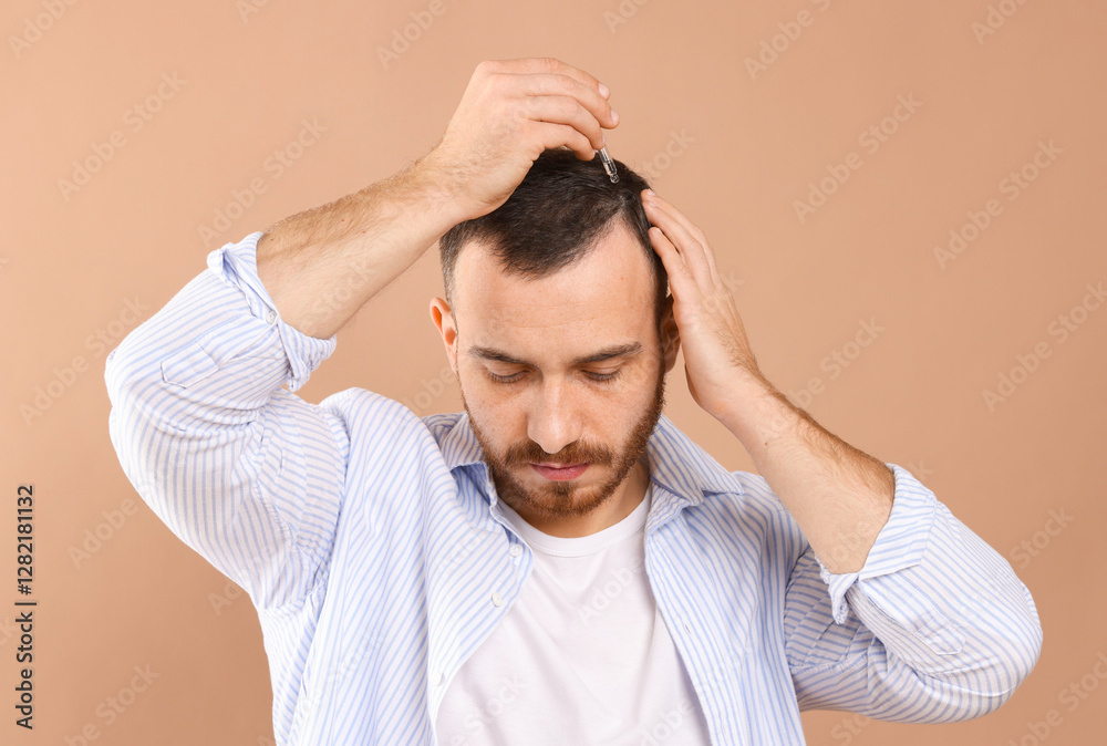 Baldness treatment. Man applying serum onto hair on beige background Baldness treatment. Man applying serum onto hair on beige background
