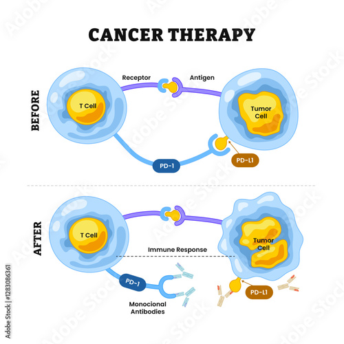 Cancer Therapy Diagram Process. Healthcare poster design, monoclonal antibodies, prevent tumor cells from bypassing immune response, labeled receptor, antigen, t-cell, tumor cell,monoclonal antibodies