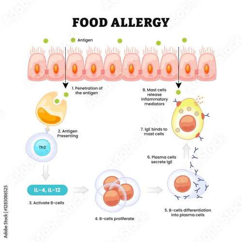 Food Allergy, abnormal immune response to food, labeled penetration of antigen, presenting, TH2, B-cell activation and proliferate, plasma cell, IgE, mast cell,inflammatory mediator. Biology education