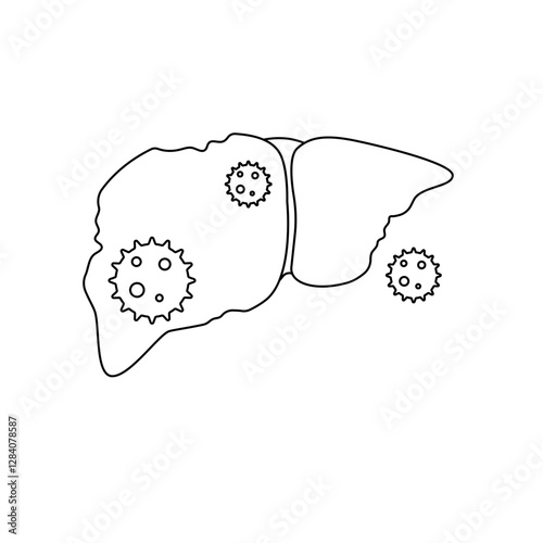 hepatitis disease