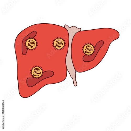 hepatitis disease illustration