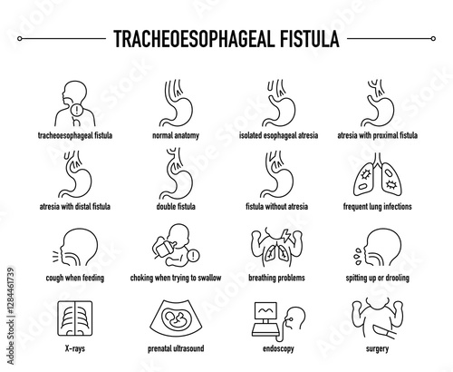 Tracheoesophageal Fistula symptoms, diagnostic and treatment vector icon set. Line editable medical icons