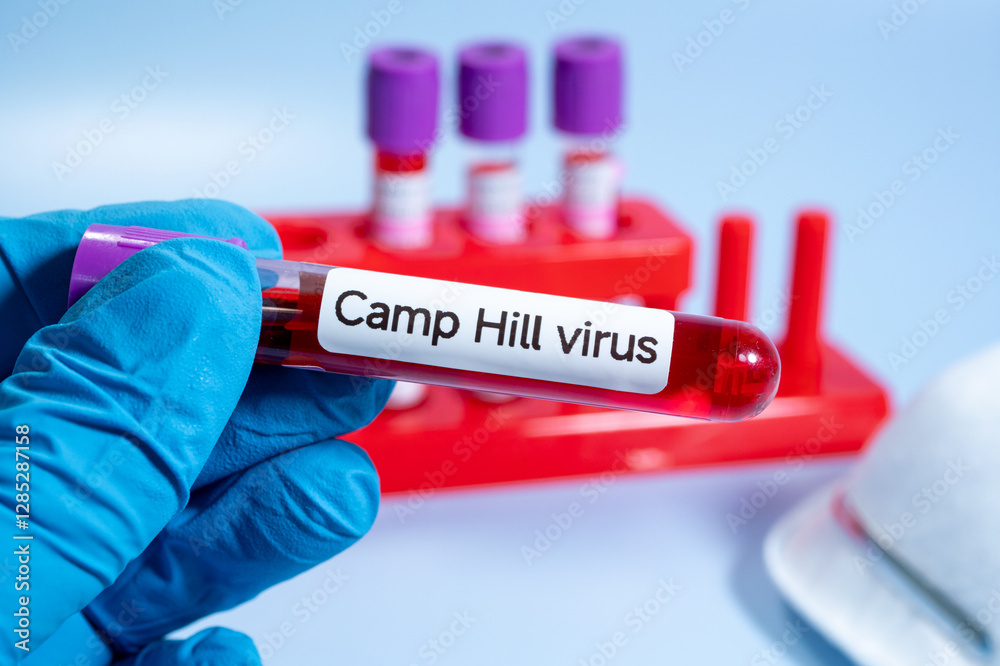 Obraz premium A new pathogen, called Camp Hill virus, was recently discovered in Alabama, drawing attention to a group of viruses known as henipaviruses