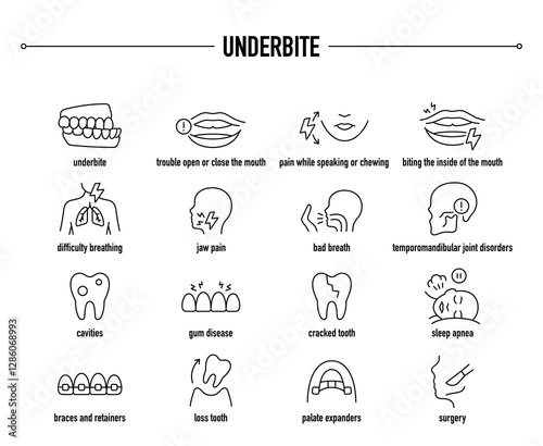 Underbite symptoms, diagnostic and treatment vector icon set. Line editable medical icons.