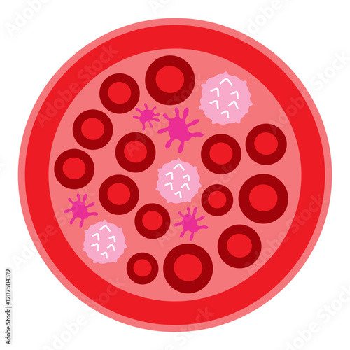 polycythemia vera