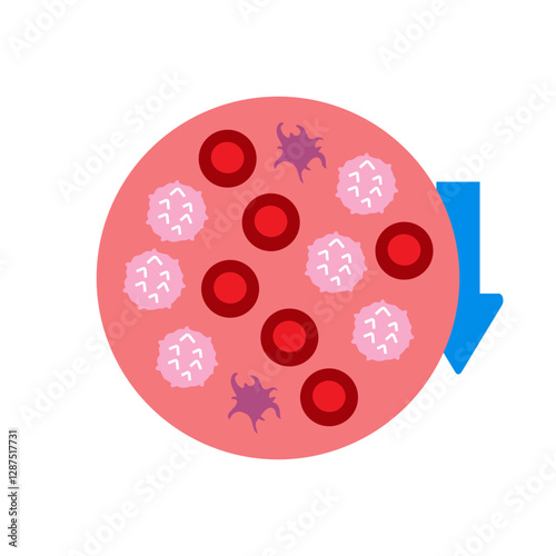 Thrombocytopenia