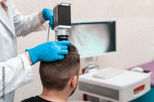 Female doctor looks at a man's scalp with a dermatoscope. Diagnosis of scalp condition by a trichologist. Mole examination, baldness, hair transplantation photo