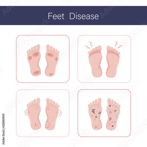 Dirty human bare foot, various microorganisms and bacterias on feet. Unsanitary conditions, various pathogens and parasites on unwashed footstep. Health care