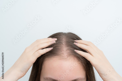 Close up view young woman massaging her scalp with hands for stimulating new hair growth, copy space. Receding hairline. Alopecia treatment, scalp stimulation, hair loss and baldness targeted therapy.