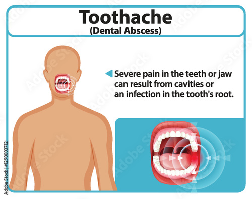 Understanding Toothache and Dental Abscess