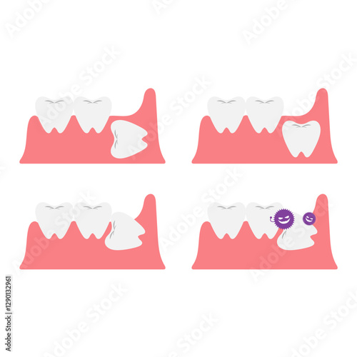 親知らずの歯のイラストセット