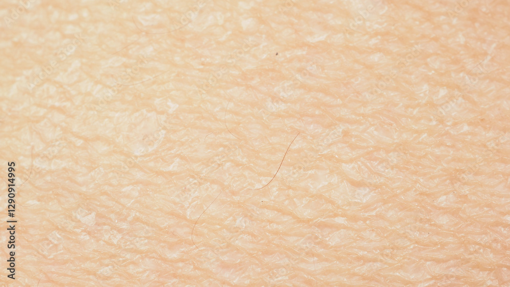 Fototapeta premium Dry skin.Close up picture