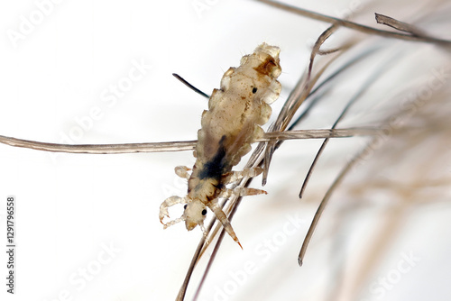 Head louse, Pediculus humanus capitis, on a human hair.