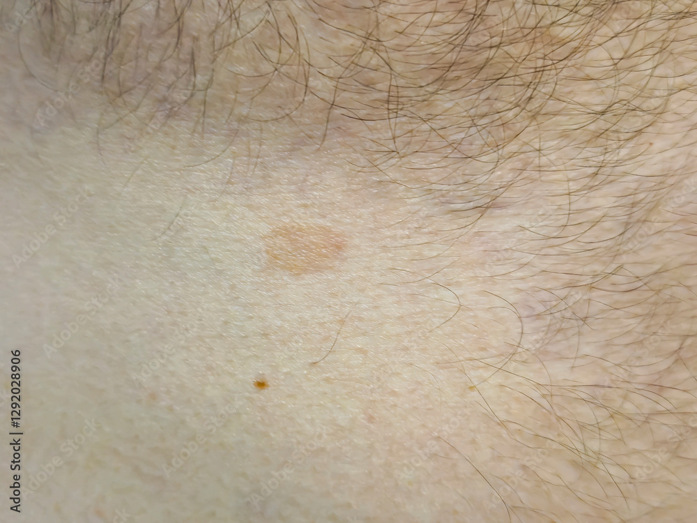 Fototapeta premium Close-up image of skin showing a mole and hair