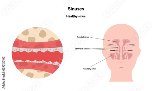 Sinuses anatomy healthy sinus. Nose nasal anatomy. Healthy Nasal Cavity 