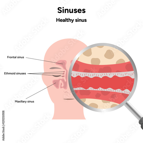 Sinuses anatomy healthy sinus. Nose nasal anatomy. Healthy Nasal Cavity 