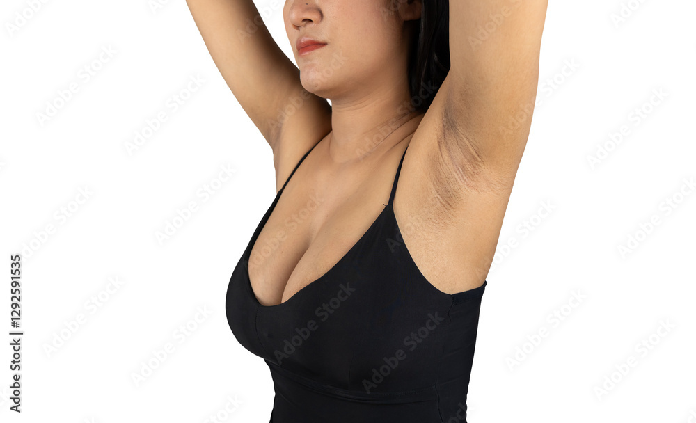 Dark armpit problems of women after pregnancy and skin care and beauty concepts isolated Dark armpit problems of women after pregnancy and skin care and beauty concepts isolated