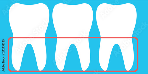 Vector illustration of a row of teeth in the gingiva