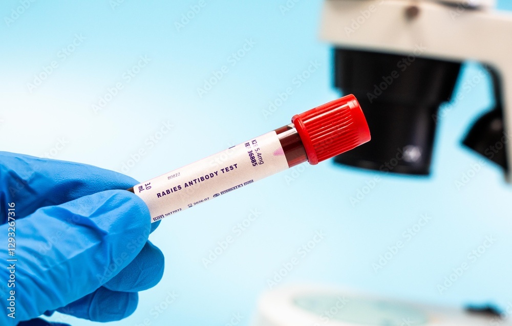 Naklejka premium Detects antibodies to rabies virus, indicating exposure or vaccination.