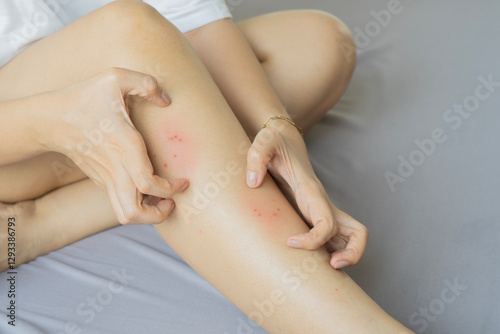 Cropped shot of young woman suffering from skin allergy, scratching her legs with fingers.