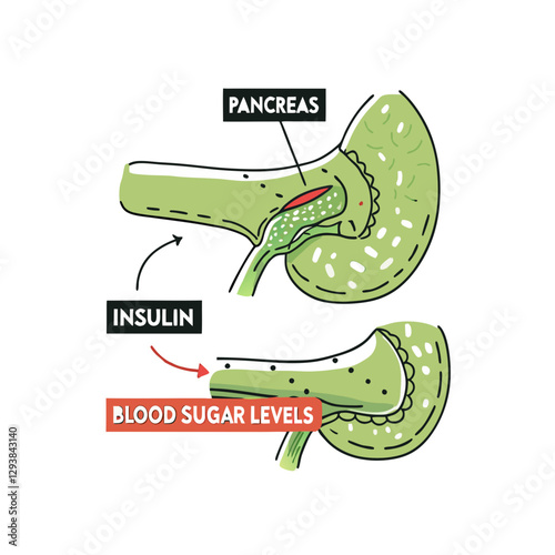 Vector illustration of the pancreas function, showing insulin production and its effect on blood sugar levels. Ideal for medical and educational use.