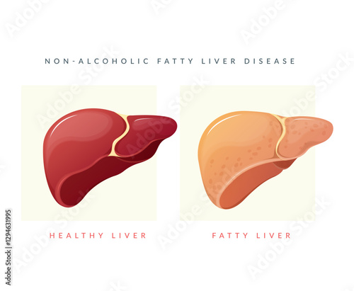 Liver with Liver cell and fat cells - Stock Illustration