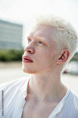 A beautiful young man with albinism, featuring fair skin, white hair, and delicate features. He looks confident and serene, with soft natural lighting highlighting her unique beauty
