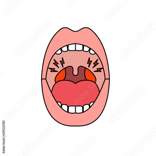 tonsil