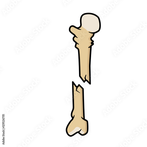 bone fracture
