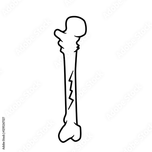 bone fracture