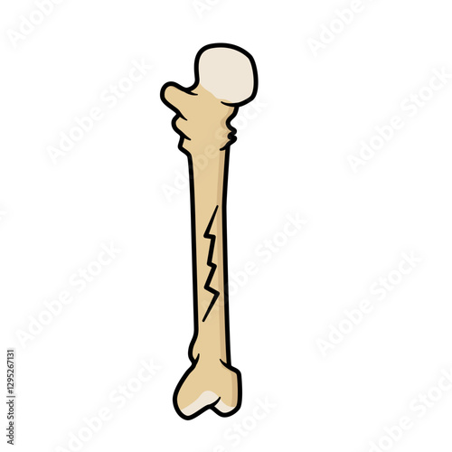 bone fracture
