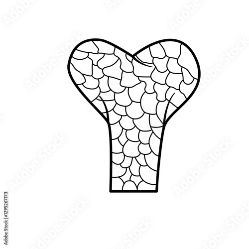 bone fracture