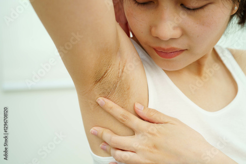 Asian woman have problem black armpit beauty skin care.