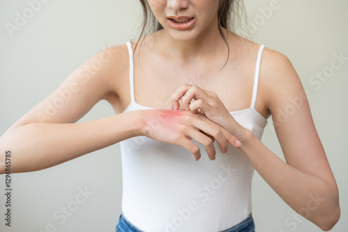 Dermatology asian young woman allergy, allergic reaction from atopic, insect bite, scratching itchy back of hand, red spot or rash of skin. Healthcare treatment of beauty. Isolated on white background