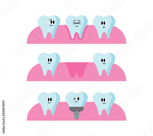 Dental Implant Procedure. 
Implant treatment process. A character with a cute expression. Simple illustration.