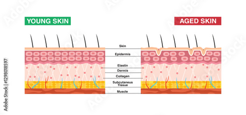 Aging process. Illustration of comparison of young and old skin. Collagen, elastin and fibroblasts in young and old skin.