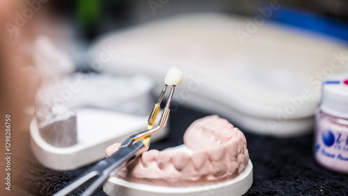 A dental technician carefully holds a crafted dental crown using tweezers over a model of teeth in a professional laboratory environment, illustrating precision in restorative dentistry.