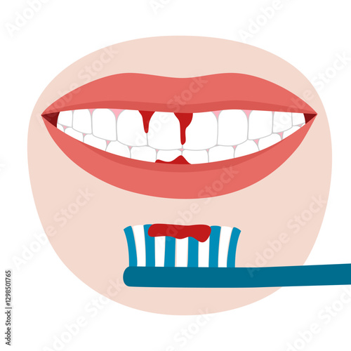 Bleeding gums during teeth brushing. Hard toothbrush problem. Periodontal disease, avitaminosis, gingivitis.