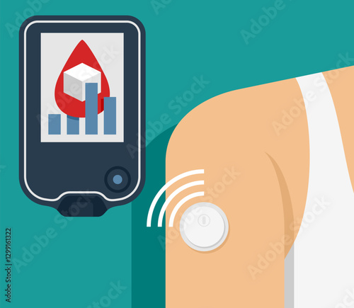 Continuous glucose monitor, sensor instead of blood drop of from a finger