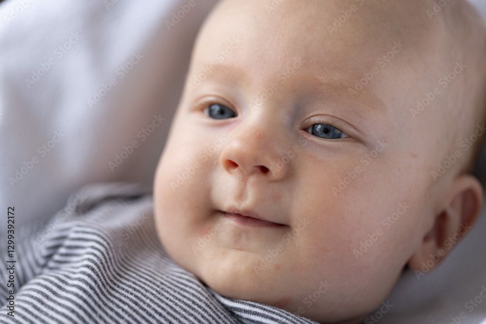 Smiling newborn baby with red pimples on the face and pink eye. Closeup. Smiling newborn baby with red pimples on the face and pink eye. Closeup.